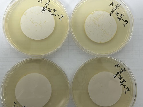 為什么微生物培養(yǎng)時平板要倒置